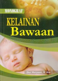 Image of Kelainan bawaan