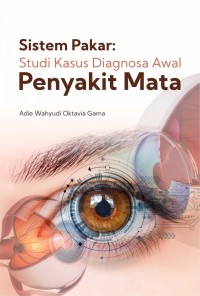Image of sistem pakar : studi kasus diagnosa awal penyakit mata