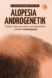 Image of Alopesia Androgenetik Tinjauan Senyawa Alami yang Berpotensi sebagai Antialopesia