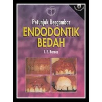 Image of Petunjuk Bergambar: ENDODONTIK BEDAH