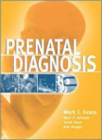 Image of Prenatal Diagnosis