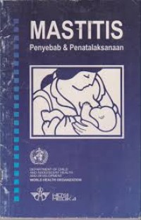 Image of MASTITIS: Penyebab dan penatalaksanaan